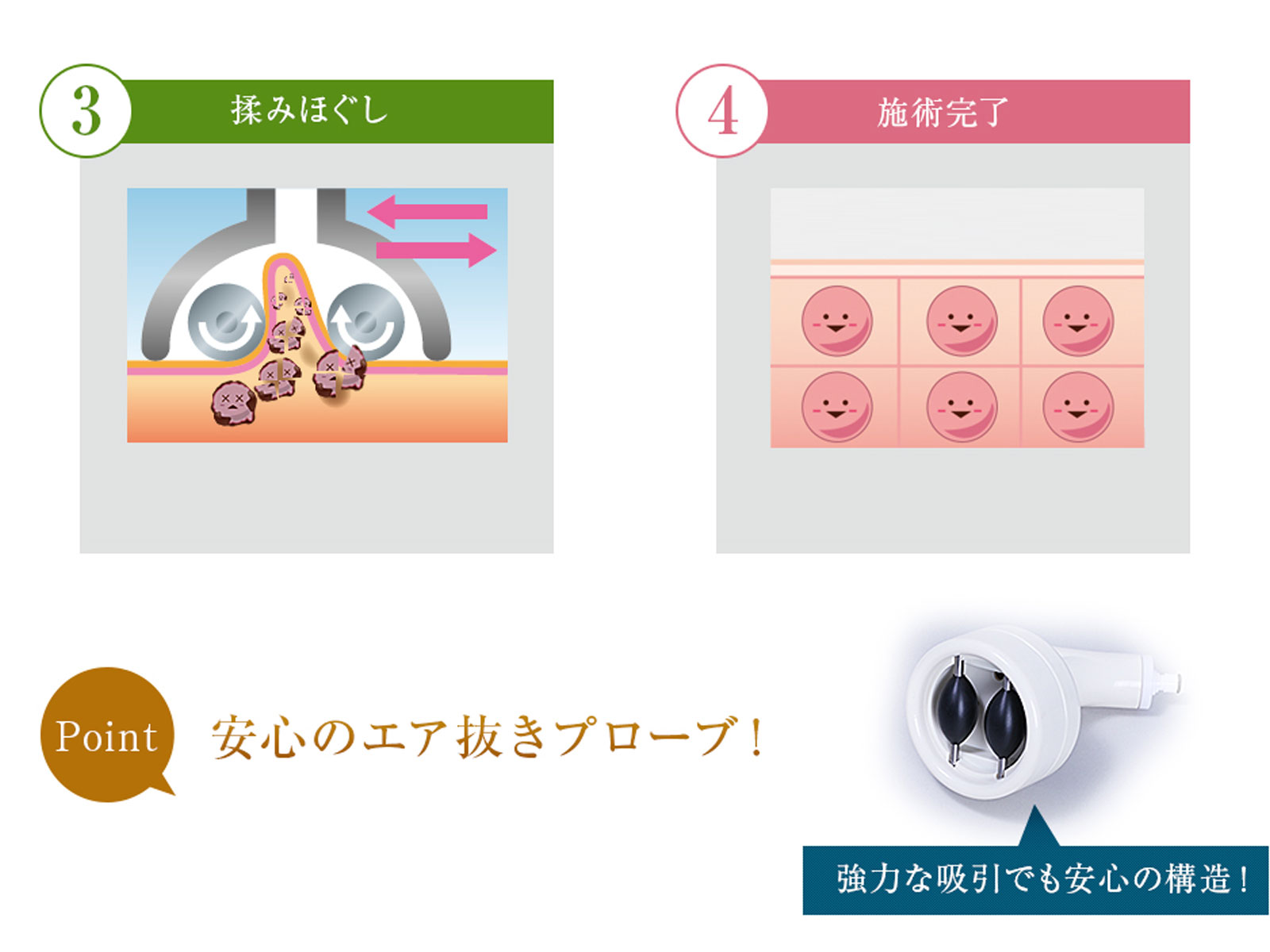 揉みほぐし → 施術完了