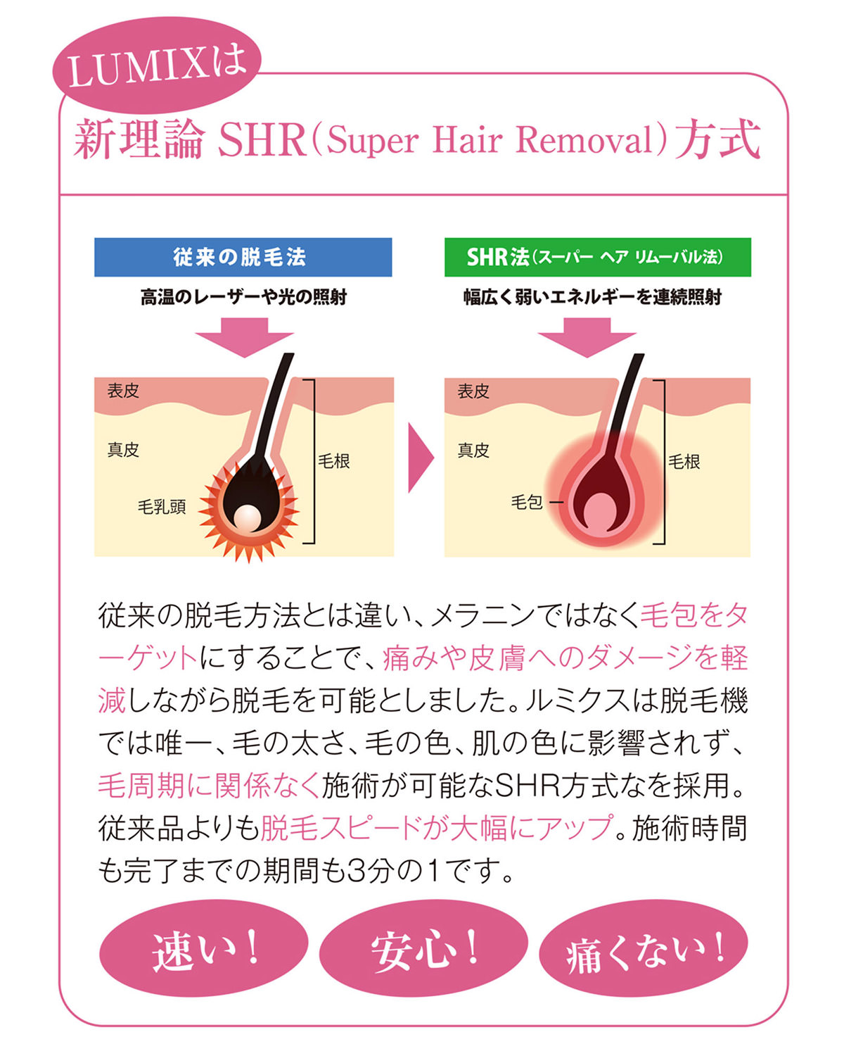 真理論 SHR 方式
